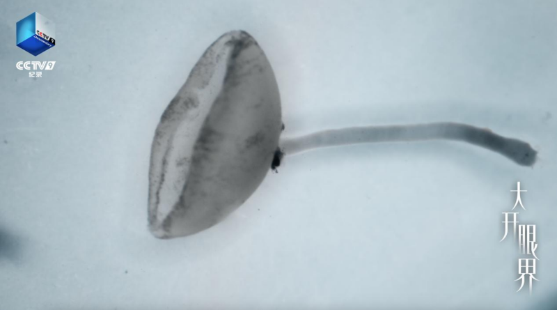 CCTV-9纪录片《大开眼界》：让眼睛真正被“看见”(图5)